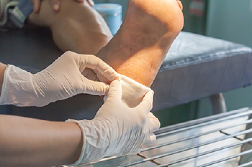 Controlling Foot Wound Odor During Recovery
