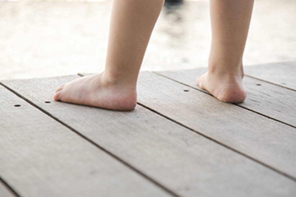Overpronation and Its Impact on Foot Health