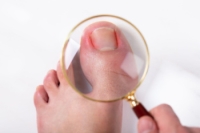 Stop Ingrown Toenails Before They Start
